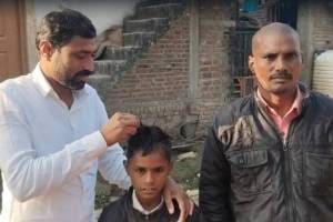 In Shegaon taluka over 50 people in three villages are rapidly losing hair