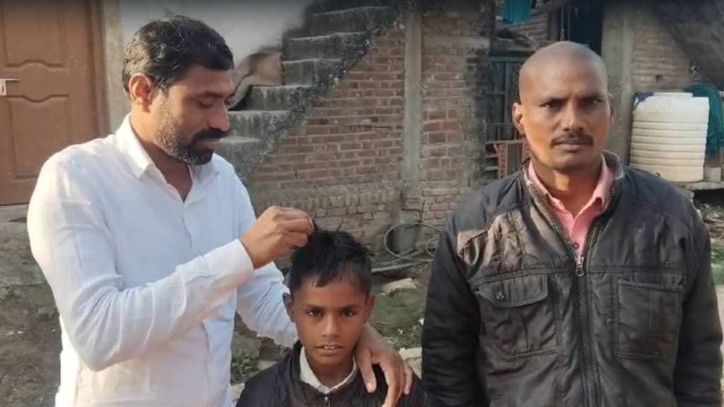 In Shegaon taluka over 50 people in three villages are rapidly losing hair