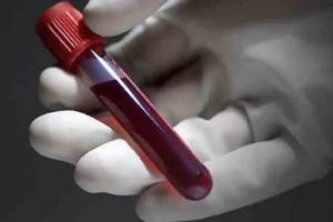 State Blood Transfusion Council lifts ban on transferring blood and blood components to other states Mumbai print news