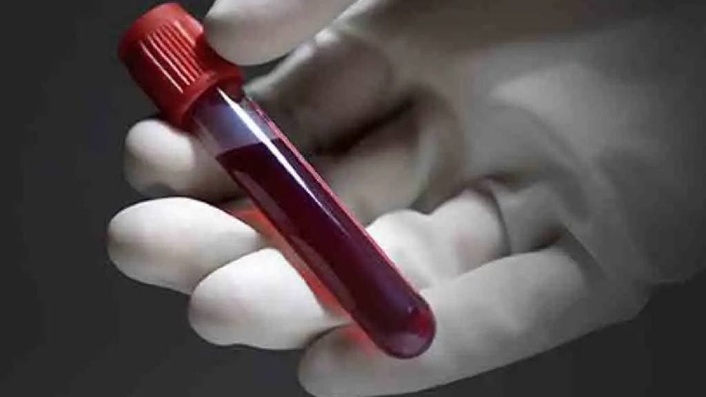 State Blood Transfusion Council lifts ban on transferring blood and blood components to other states Mumbai print news