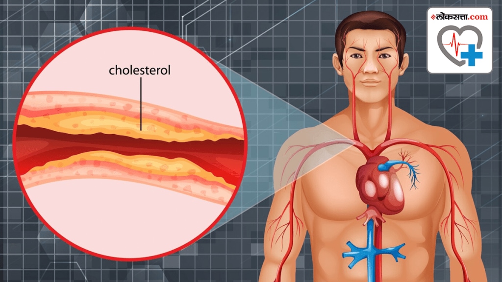 cholesterol range these Six morning habits to lower cholesterol level says cardiologist expert