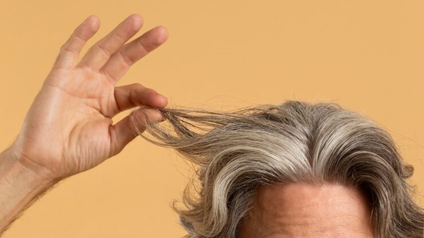 Causes of premature gray hair