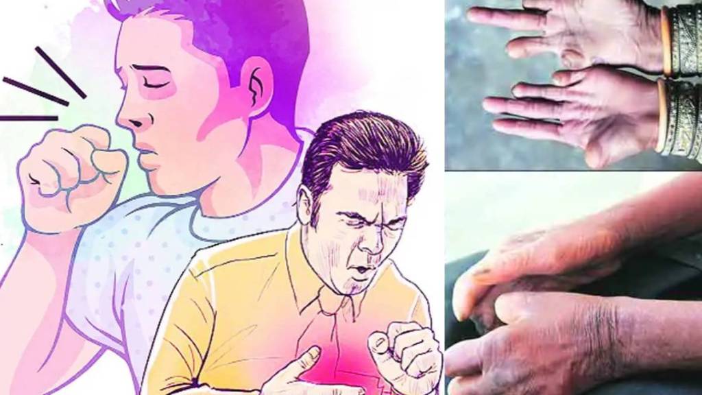 maharashtra Health Department launches leprosy and tuberculosis detection campaign in 2025