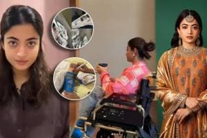 rashmika mandanna fracture 1