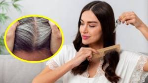 Hair Tips : पांढरे केस काही दिवसांत दिसतील काळेभोर अन् लांबसडक; करुन पाहा फक्त ‘हे’ ९ नैसर्गिक उपाय