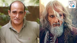 Chhaava actor akshaye Khanna opened up about his premature balding