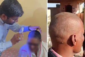 Buldhana hair loss reason