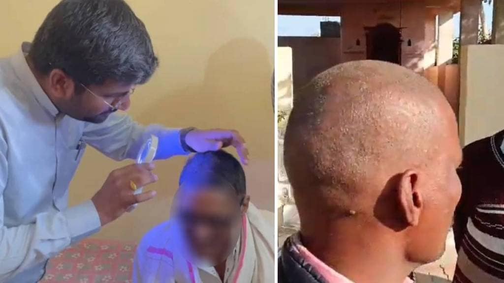 Buldhana hair loss reason