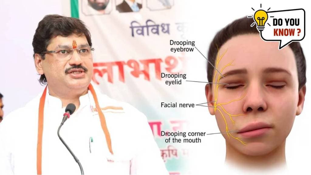 What is Bell’s Palsy Disease | Dhananjay Munde Diagnosed by Bell’s Palsy Disease