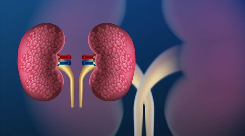 Chronic Kidney Disease