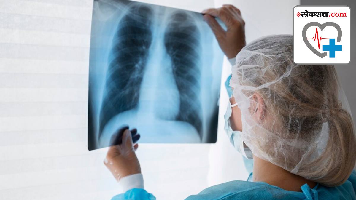 Why does lung cancer recur? It’s all in the genes, finds new study lung cancer early symptoms