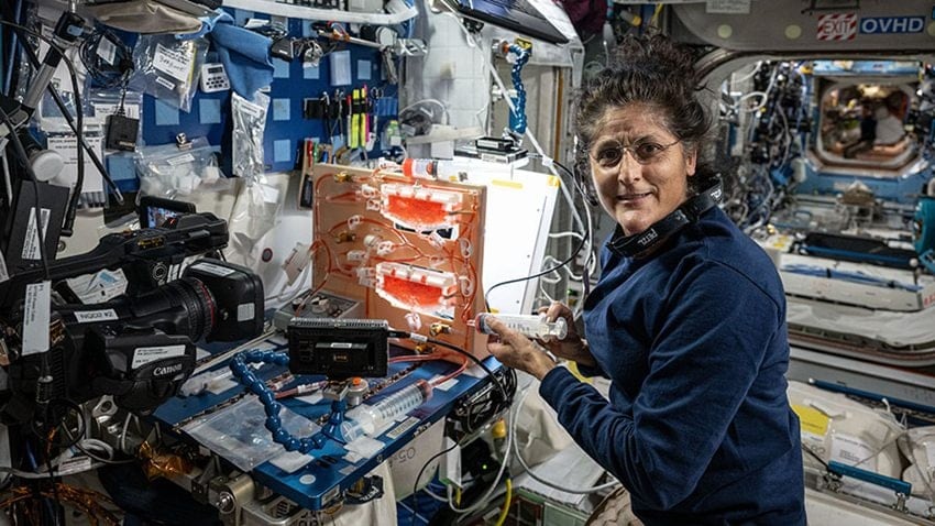 Sunita Williams Will Face Several Health Issues